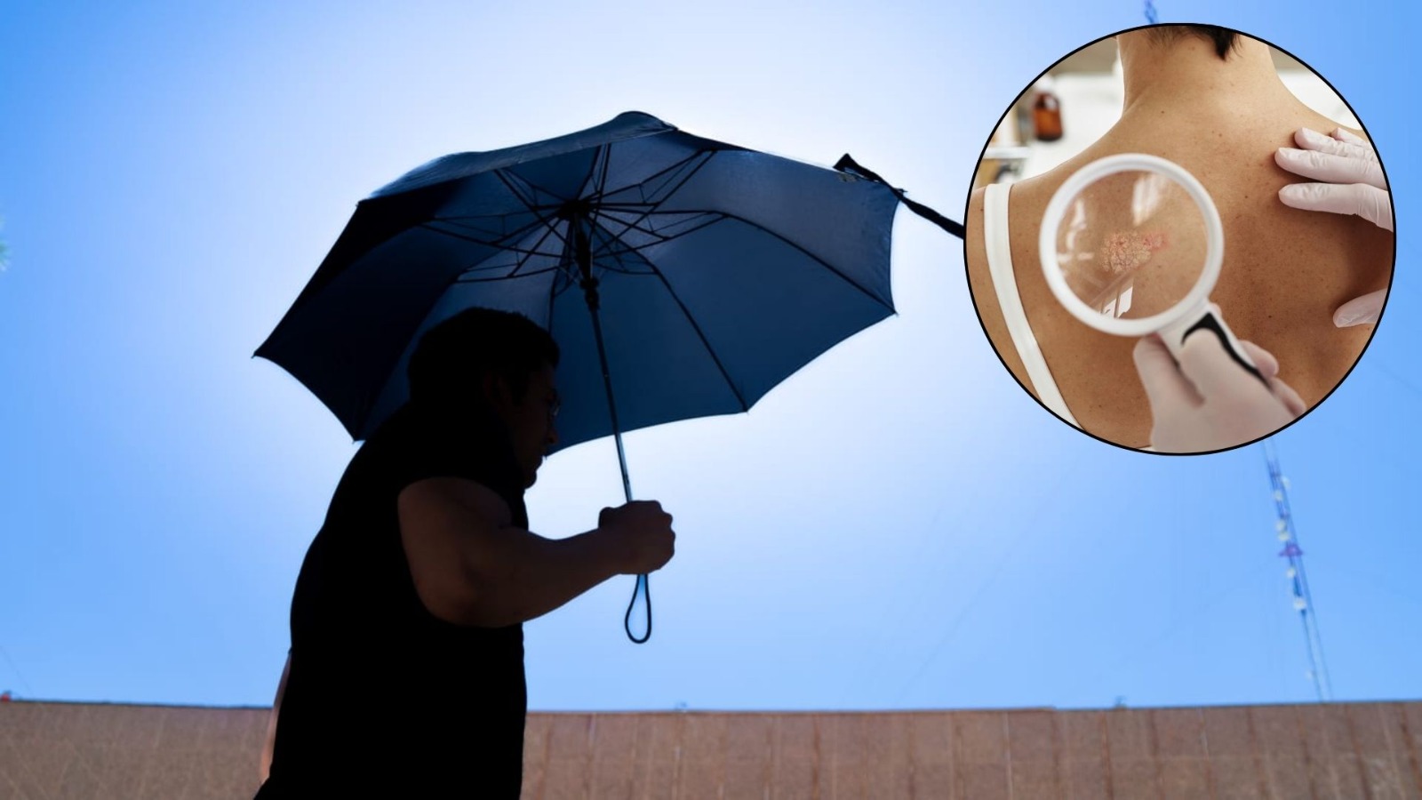 Secretaría de Salud promueve la prevención del cáncer de piel ante ola de calor.