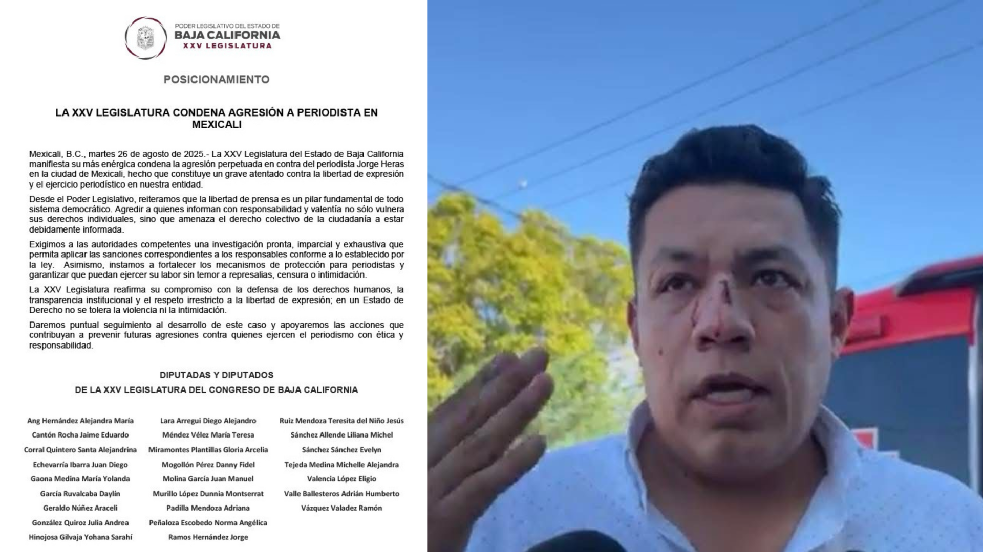 La XXV legislatura condena agresión a periodista en Mexicali